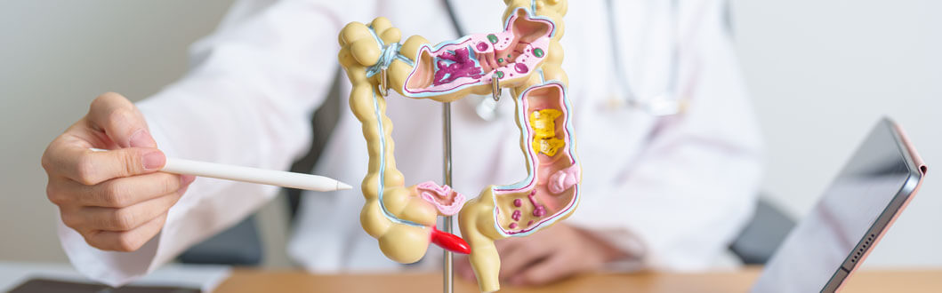 Ulcerative Colitis Featured Photo