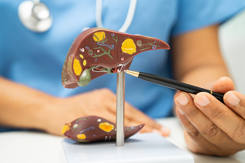 A gastroenterologist pointing to a model of an unhealthy liver