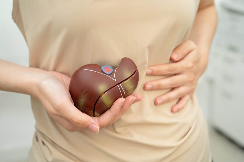 A patient holding a model of a liver