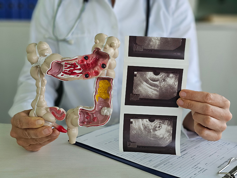 A doctor examining a patient's colonoscopy results