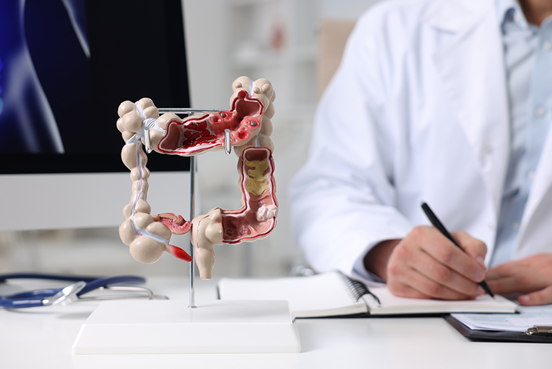 A doctor with a diagram of the intestines