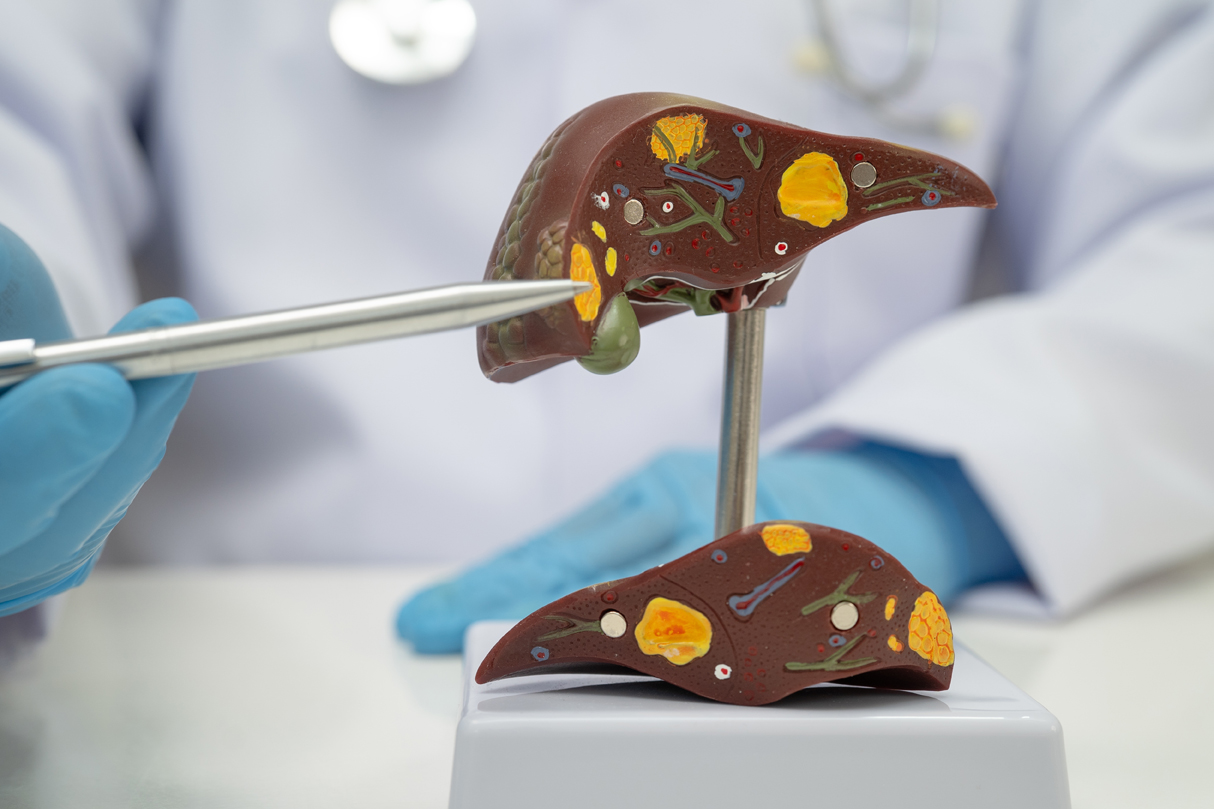 A hepatologist pointing out possible causes of liver discomfort
